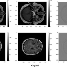GECO: A Generative Adversarial Network for MRI de-artifacting