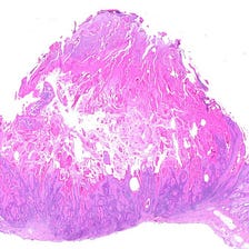 Unsupervised Pathology Whole Slide Image Slides Segmentation