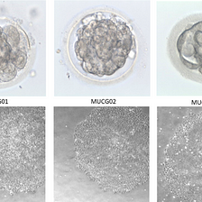 Declaring Embryos ‘People’ Devalues Human Life