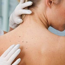 Different Types of Diseases Treated by Dermatologist