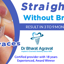 Invisible clear braces for teeth cost, price, reviews, pros-cons,  before-after from India's leading best cosmetic dentist Bharat Agravat  Ahmedabad Gujarat., by Anas Baig