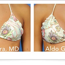 Am I a Good Candidate for Breast Augmentation?, by Guerra Plastic Surgery  Center