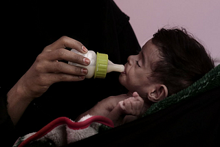 Yemen crisis: as children starve, the West averts its gaze