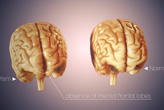 Various Treatment Approaches for Autism Spectrum Disorder