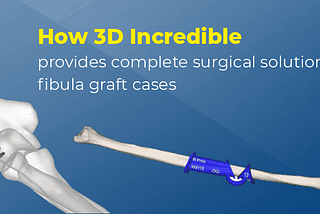 How 3D Incredible provides a complete surgical solution for fibula graft cases — 3DIncredible