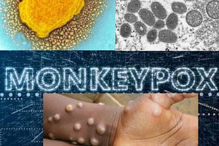 Understanding Mpox: Key Information for Protecting Global Public Health