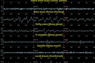 Sleep, vol. 1: intro, EEG and fMRI BOLD