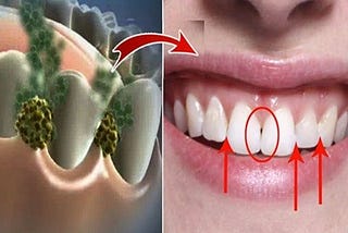 Eliminate bad breath in 5 minutes, with this simple super effective remedy — YouTube