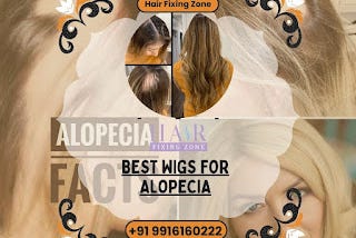 Alopecia-Friendly Wigs & Toppers for a Natural Appearance