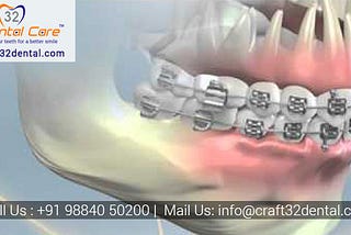 Dental Clinic in Saligramam