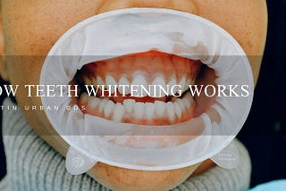 How Teeth Whitening Works
