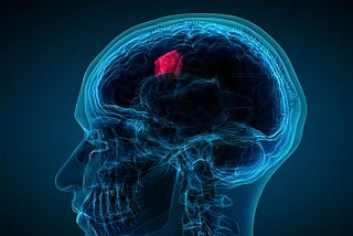 Brain Tumor Segmentation using Deep Learning models