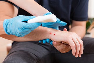 Symptoms and Precautions with Snake Bites