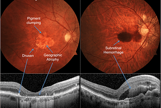 Dr. Zuhal Butuner Breaks Down The Most Common Vision Disorders And How To Diagnose Them