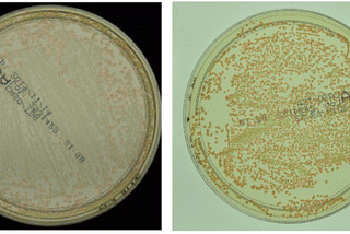 Recognition and Counting of Microorganisms on Petri Dishes