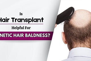 Is-Hair-Transplant-Helpful-For-Genetic-Hair-Baldness-min.jpg
