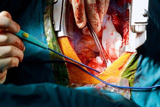 Applications for Video-Assisted Minimally Thoracic Surgery