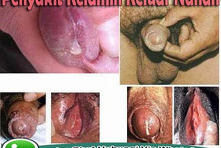 Obat Kencing Sakit Dan Tidak Lancar