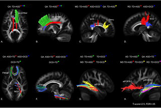 MRI classification using Intel oneAPI and Keras [AI for Autism]