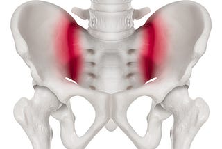 The lower back pain secret: Sacroiliac Joint Instability