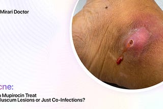 Can Mupirocin Treat Molluscum Lesions or Just Co-Infections?