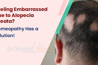 What Makes Alopecia Areata Homeopathic Treatment So Effective?