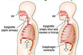 What are Hiccups and how to get rid of Hiccups?