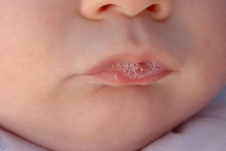 “Morning Saliva for Your Acne Scars!” Eww to Wow Moment!!