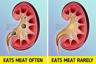 This Happens to Our Body When We Eat Too Much Meat