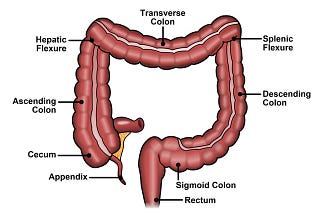 Colorectal Cancer Cases Increasing In Young Adults
