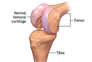 Partial knee replacement