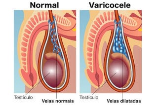 Obat Varikokel Terbaik