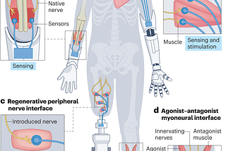 Prelude to a new era of bionics