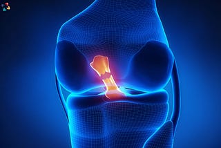 Meniscus Tear Rehab: 20 Essential Exercises for Optimal Recovery