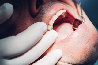 What Are The Different Types of Issues Faced By People with Their Teeth?