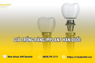 Giá Trồng Răng Implant Hàn Quốc Bao Nhiêu? Cập Nhật 2024