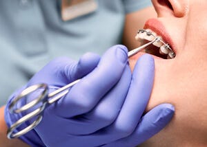 Common Orthodontics Practices