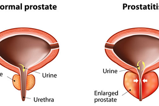 Gorilla Flow Prostate Formula Cost, Working & Official Website In The USA