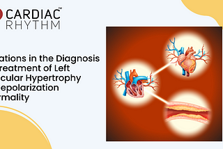 Innovations in the Diagnosis and Treatment of Left Ventricular Hypertrophy with Repolarization…