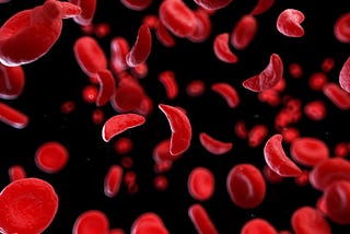 Hypnosis for alleviating pain in sickle cell disease