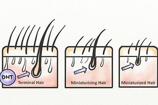 3 DHT Blocker Shampoos | New Hair Growth in 2022