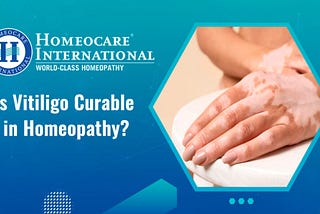 Is Vitiligo Curable in Homeopathy?