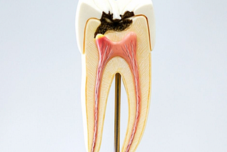 What Is Tooth Pain and how to prevent it?