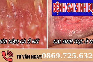 Gai sinh dục nữ xuất hiện khi nào | Bác sĩ giải đáp