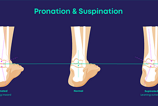 Mastering Supination: Understanding and Managing Outward Foot Roll for Optimal Health