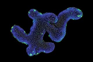 Organoids: changing lives from a petri dish?