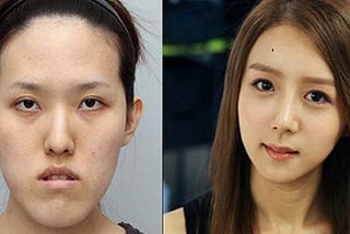 Why is Plastic Surgery so Popular in South Korea?