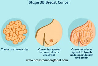 What is the meaning of stage 3 breast cancer?