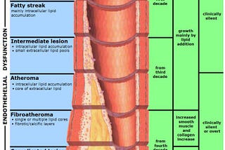 Best Way to Kill the Silent Killer — Atherosclerosis