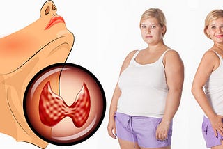 Effective Strategies for Losing Weight with Hypothyroidism